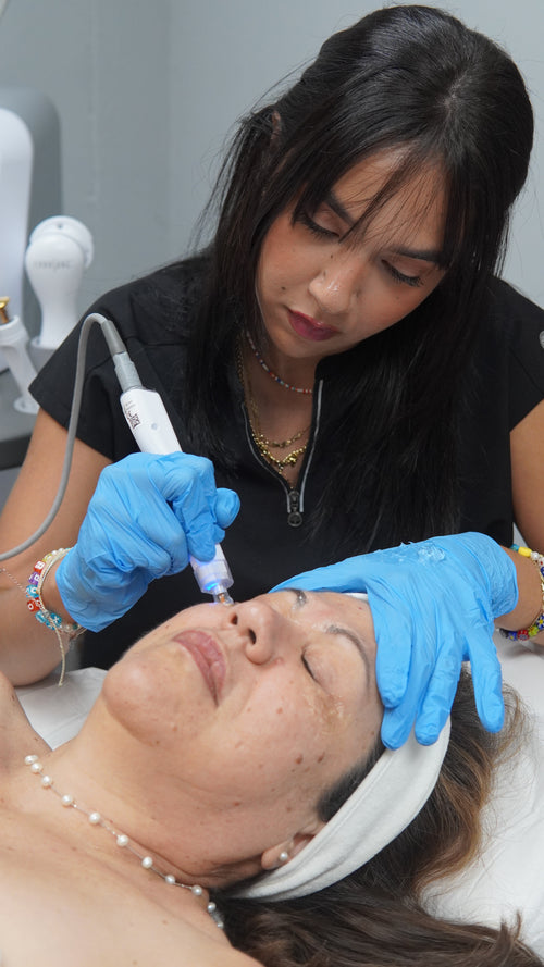 TempSure (Radiofrecuencia)