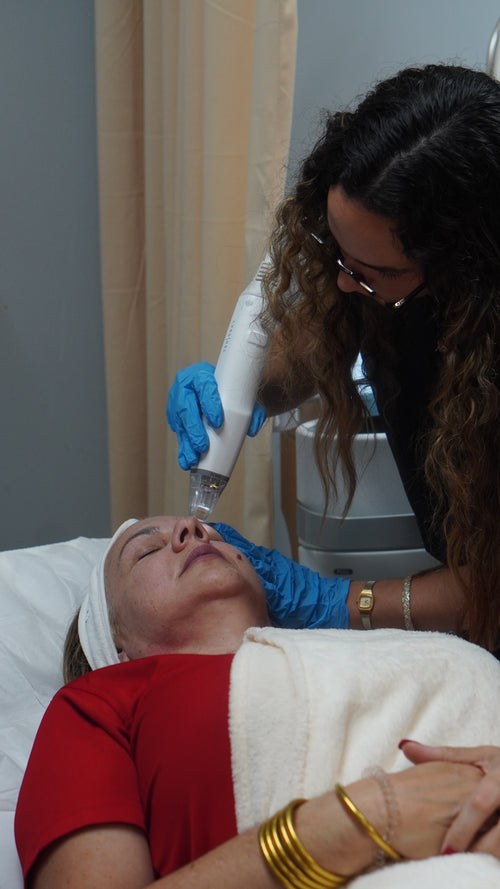 Potenza (Radiofrecuencia + Microagujas)